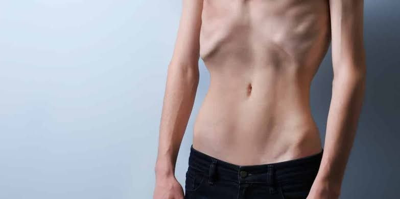 Bagian Tubuh Kurus Bisa Mempunyai Dampak Negatif